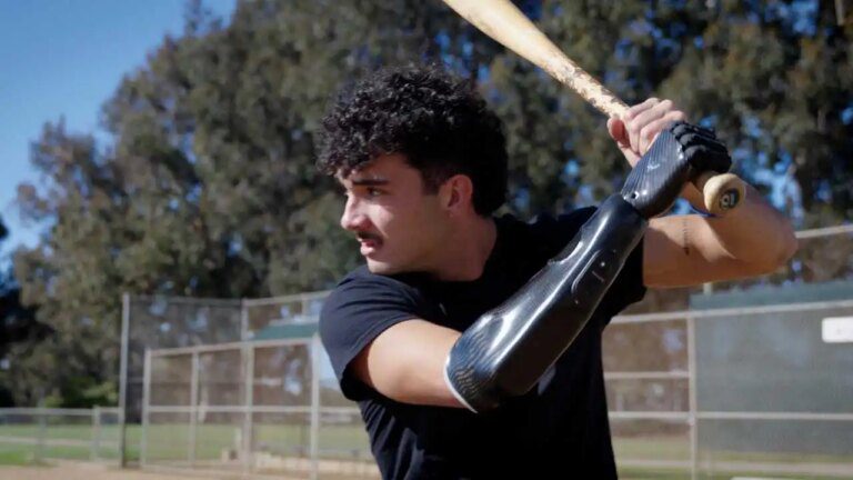 1-bionic-hand-brings-baseball-star-back-to-the-field.jpg