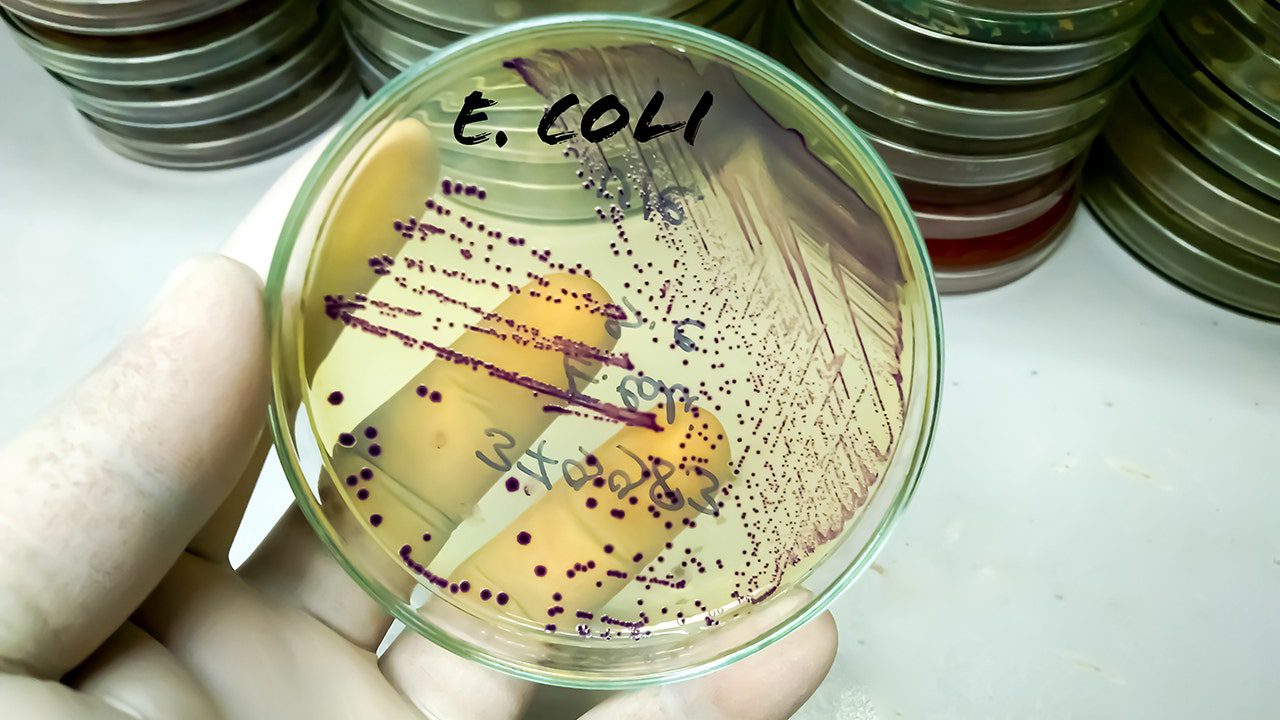 e.coli-petri-dish-lab-scientist-foodborne-illness.jpg