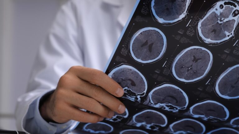 doctor-reading-brain-scan.jpg