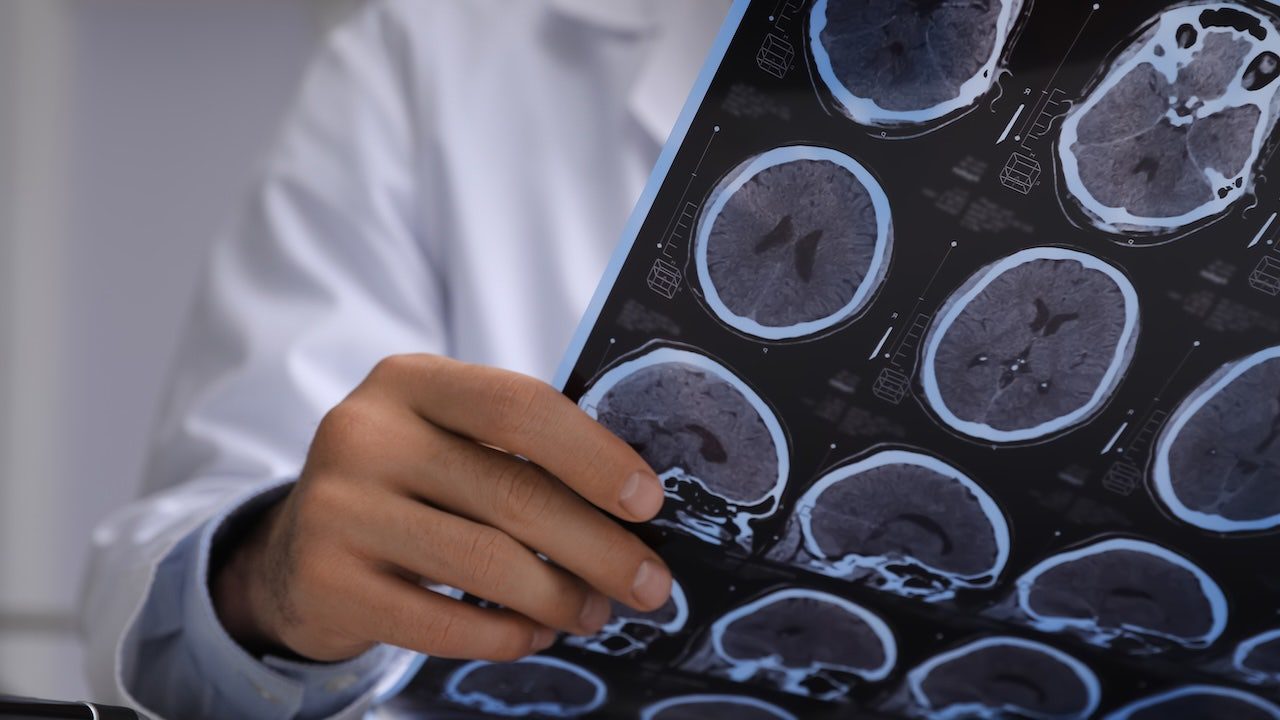 doctor-reading-brain-scan.jpg
