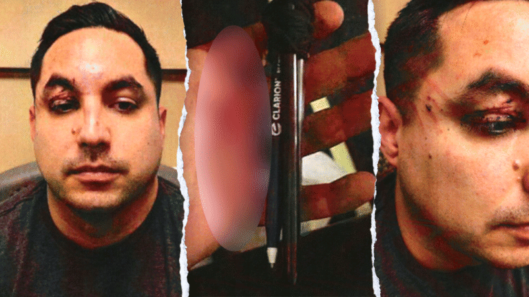 Pen_knife_attack_on_Las_Vegas_flight_fox_news_001.png
