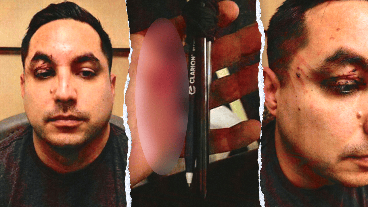 Pen_knife_attack_on_Las_Vegas_flight_fox_news_001.png