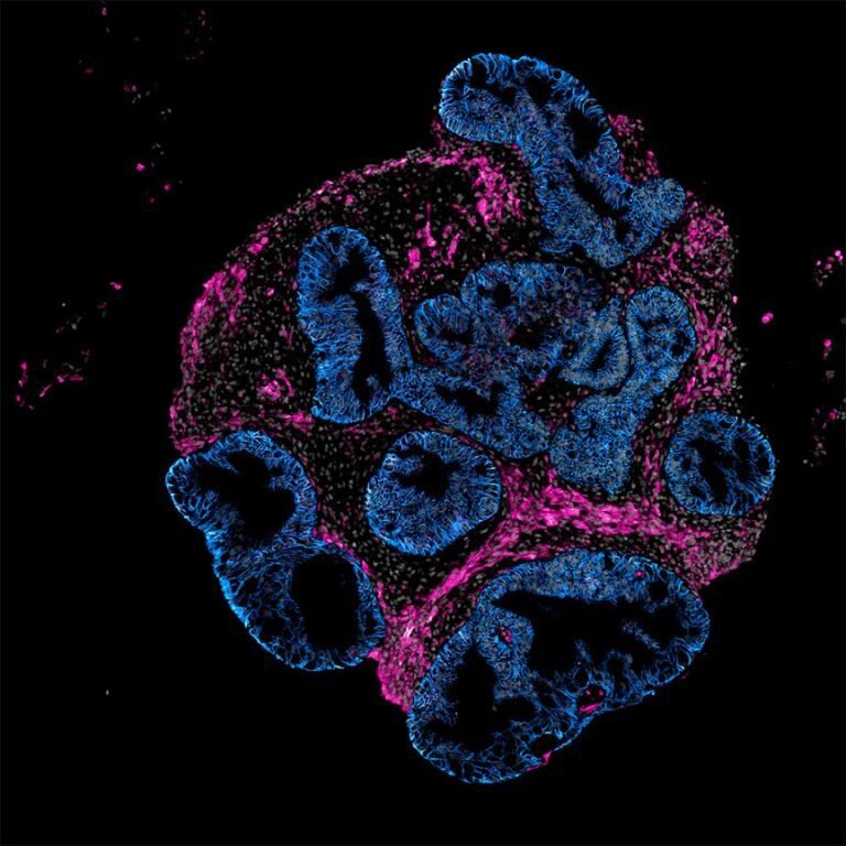 2DOrganoidSlice_greynuclei_pinksmoothmuslce_blueepithelium_INTEROBIO.jpg